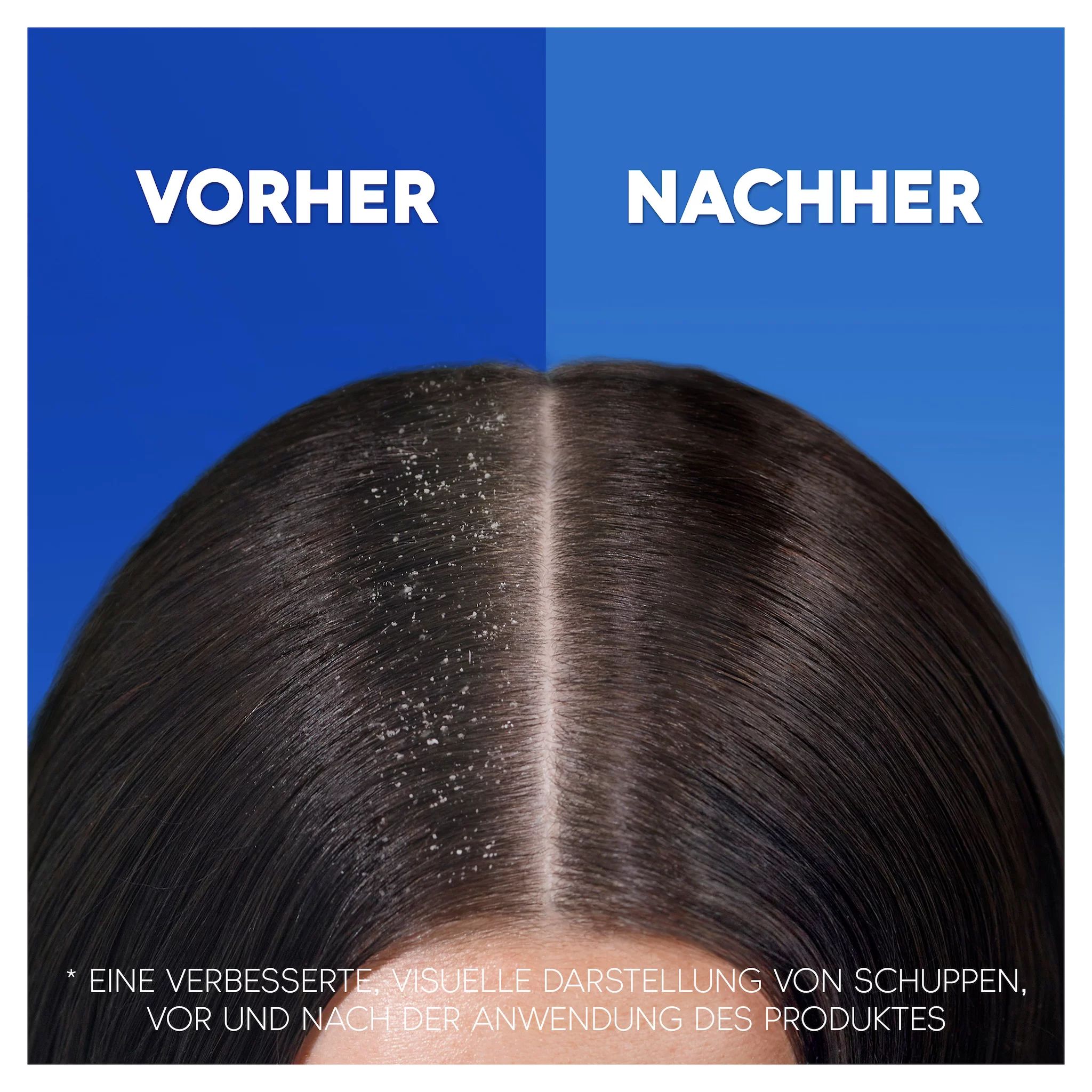 Head & Shoulders Anti-Schuppen Shampoo Classic Clean