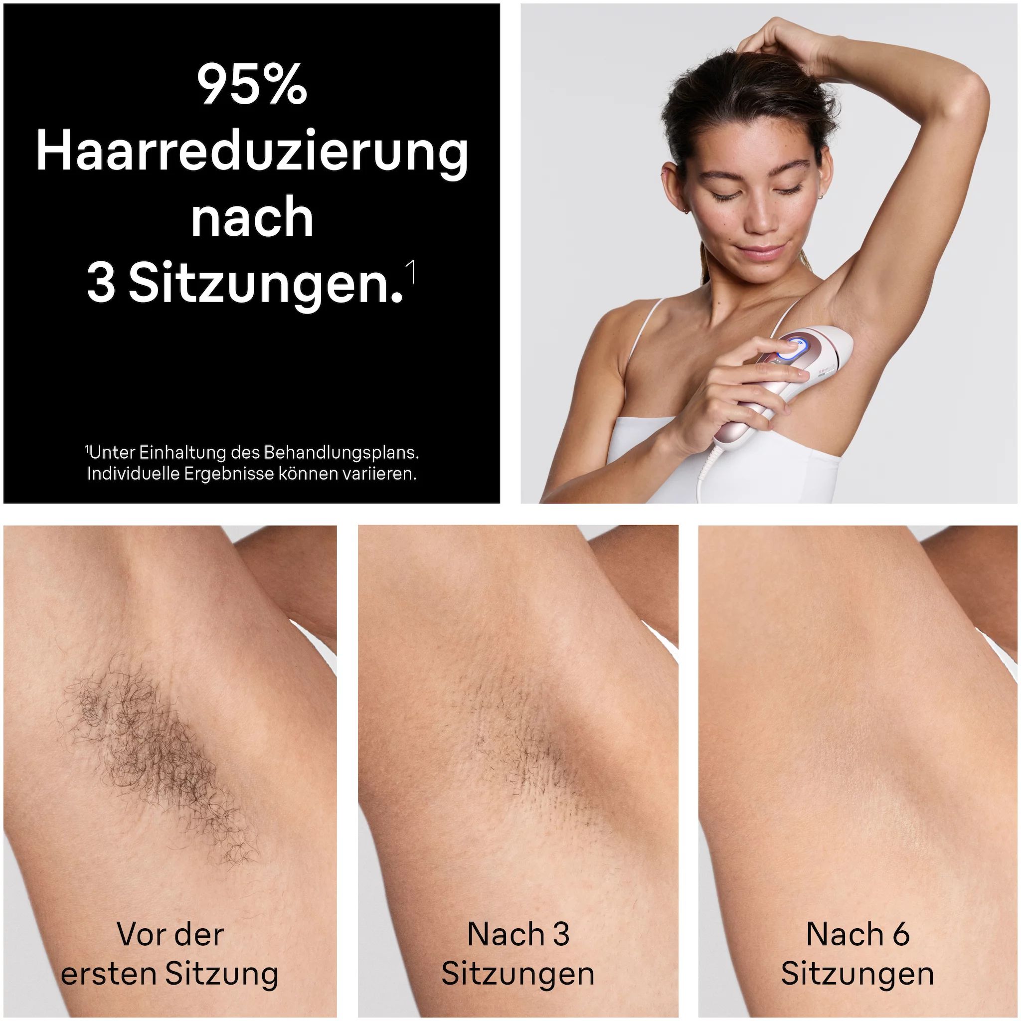 Braun Skin i-expert Pro IPL PL7432
