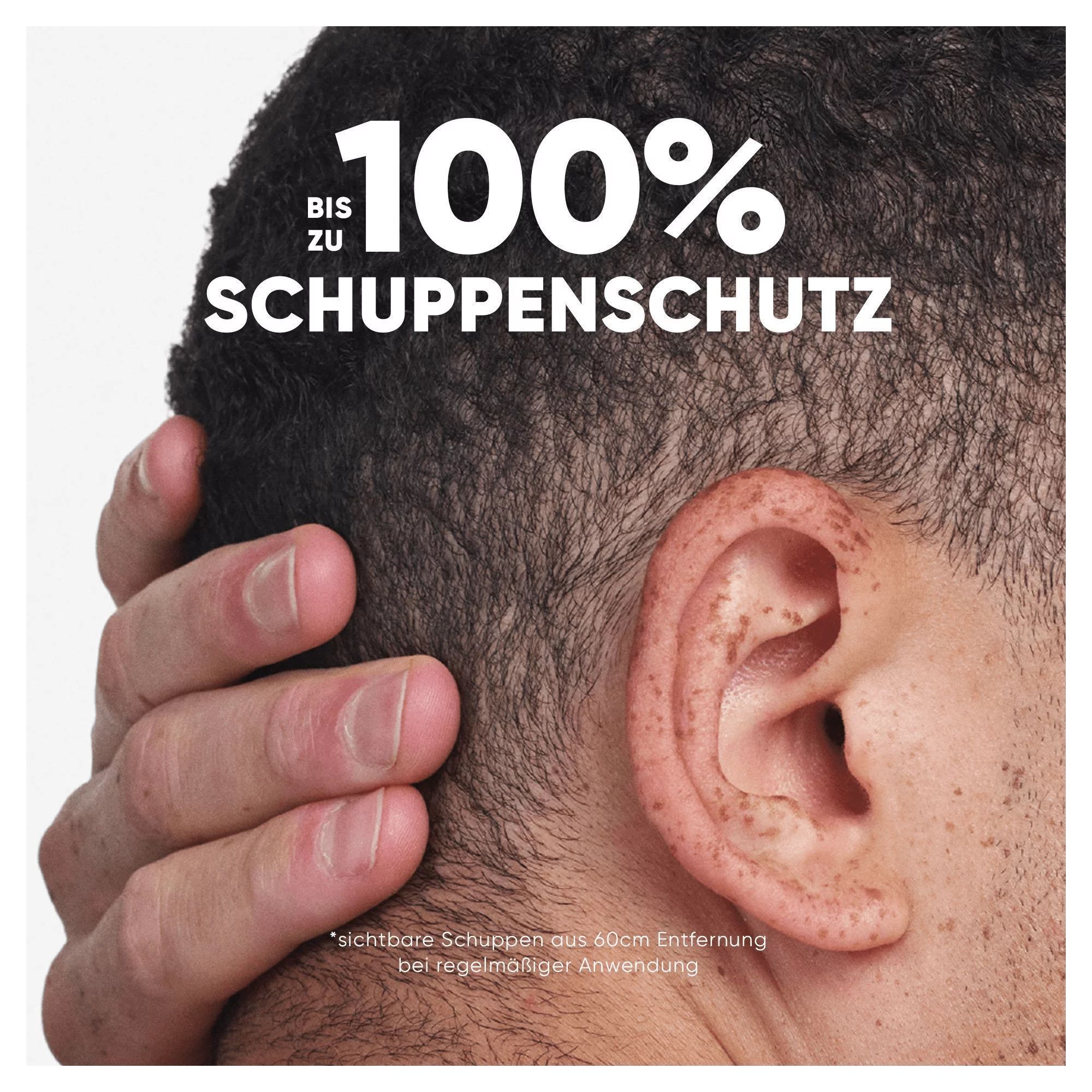 Head & Shoulders Anti-Schuppen Shampoo 2in1 citrus fresh