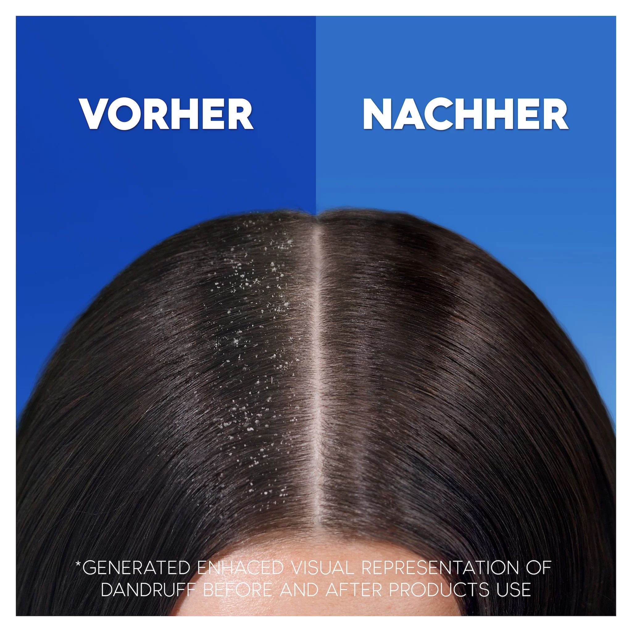 Head & Shoulders Anti-Schuppen Shampoo Classic Clean