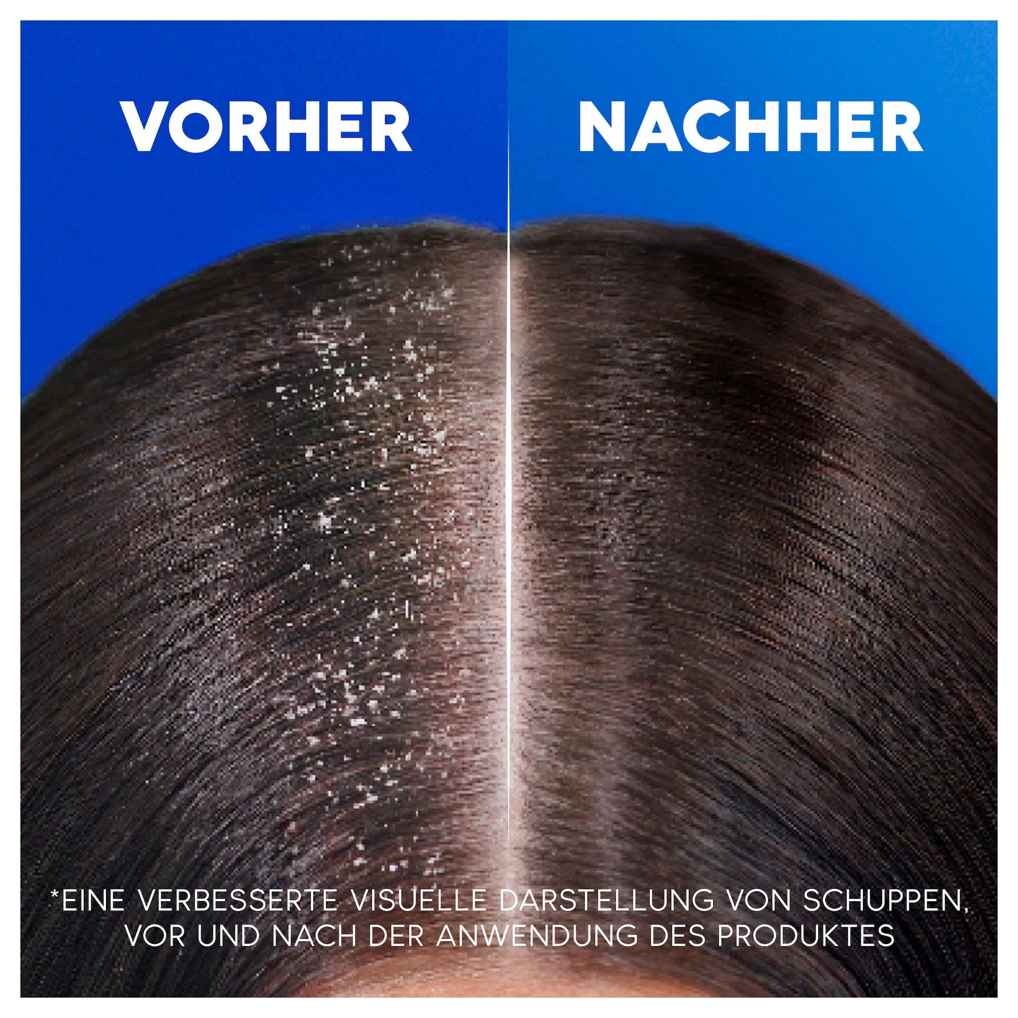 Head & Shoulders Anti-Schuppen Shampoo apple fresh