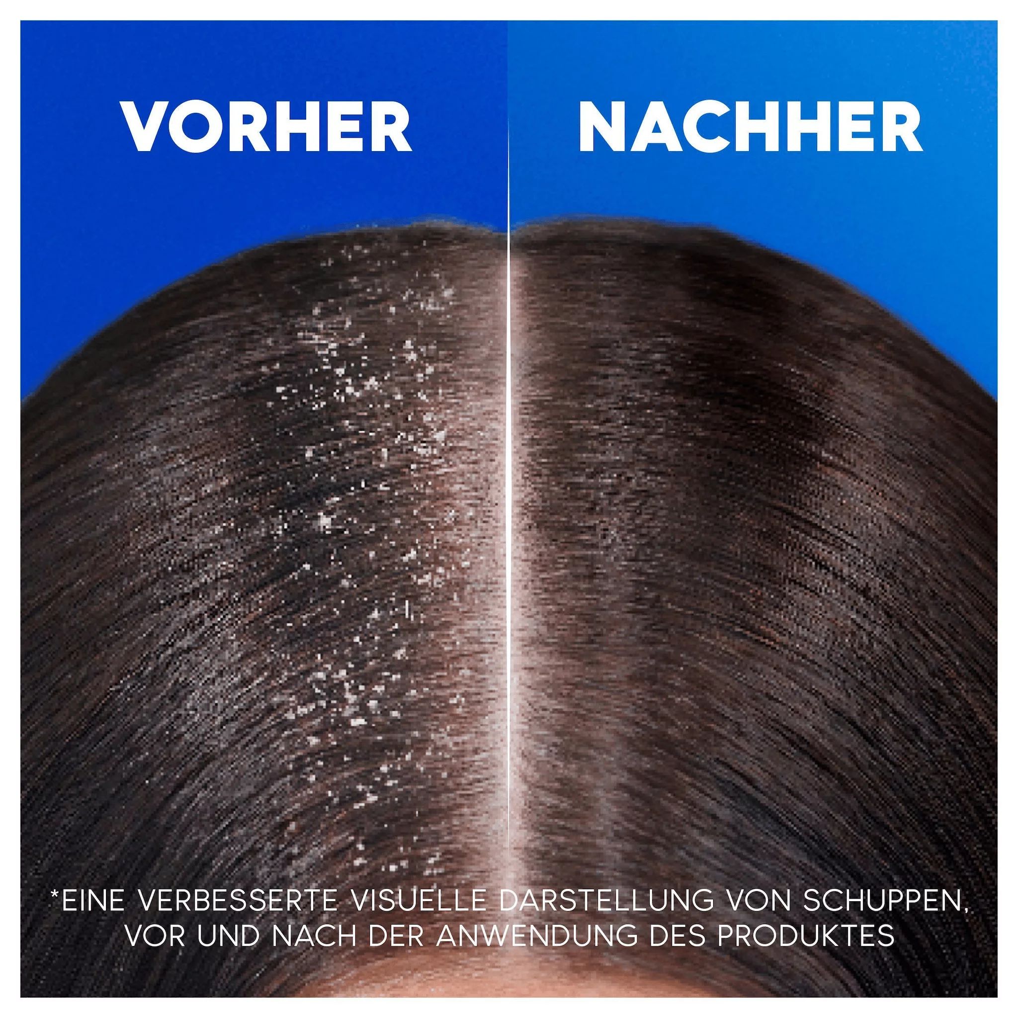 Head & Shoulders Anti-Schuppen Shampoo Sensitive