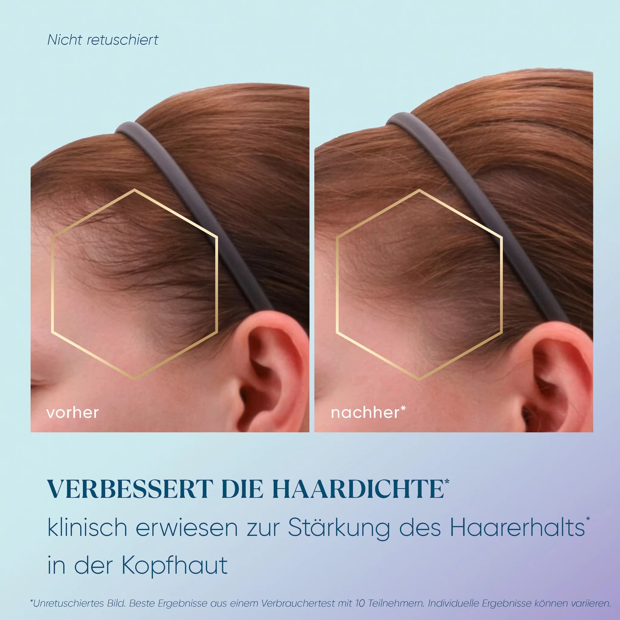 Head & Shoulders Derma X Pro Kopfhaut Serum Density & Growth