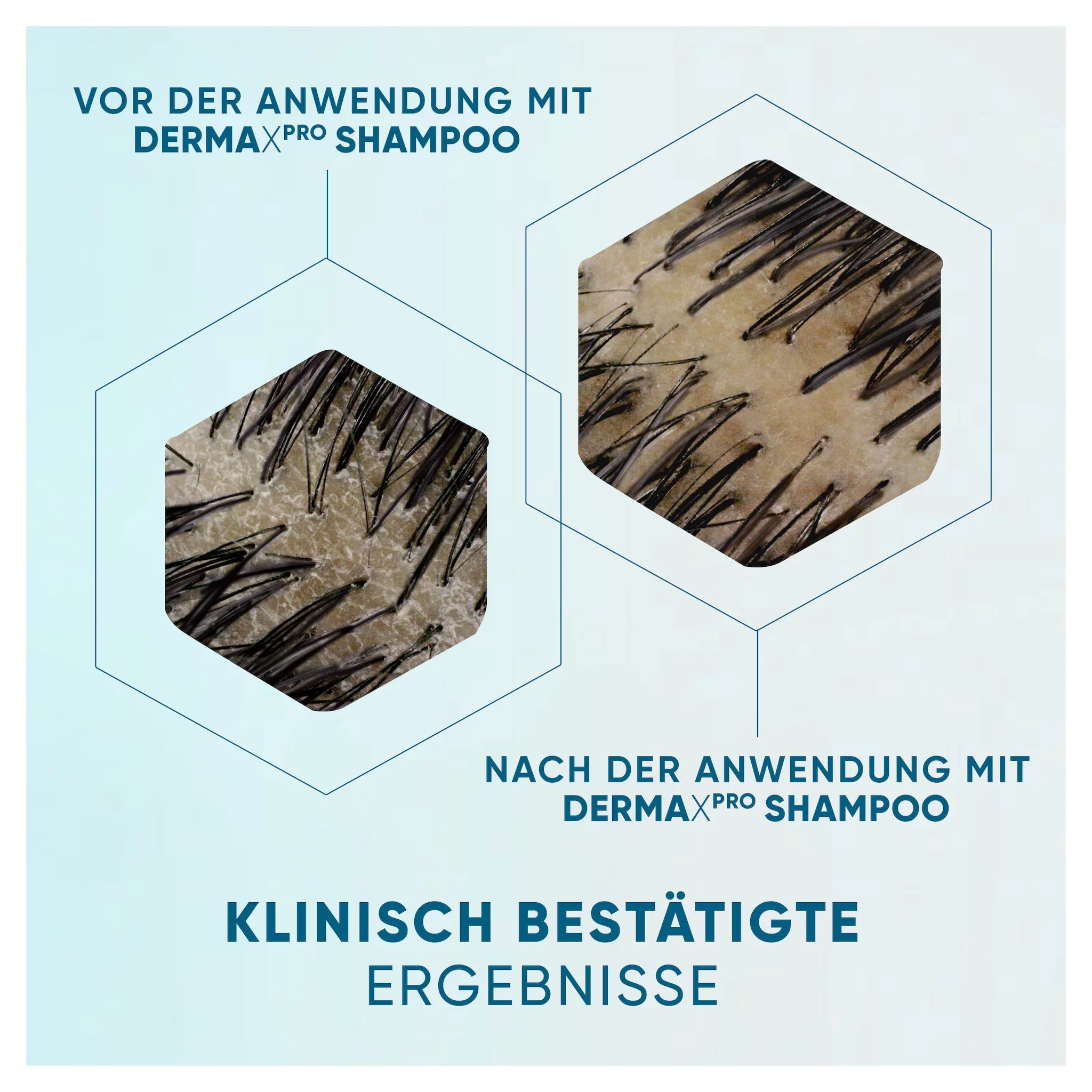 Head & Shoulders Derma X Pro Shampoo Beruhigende Pflege