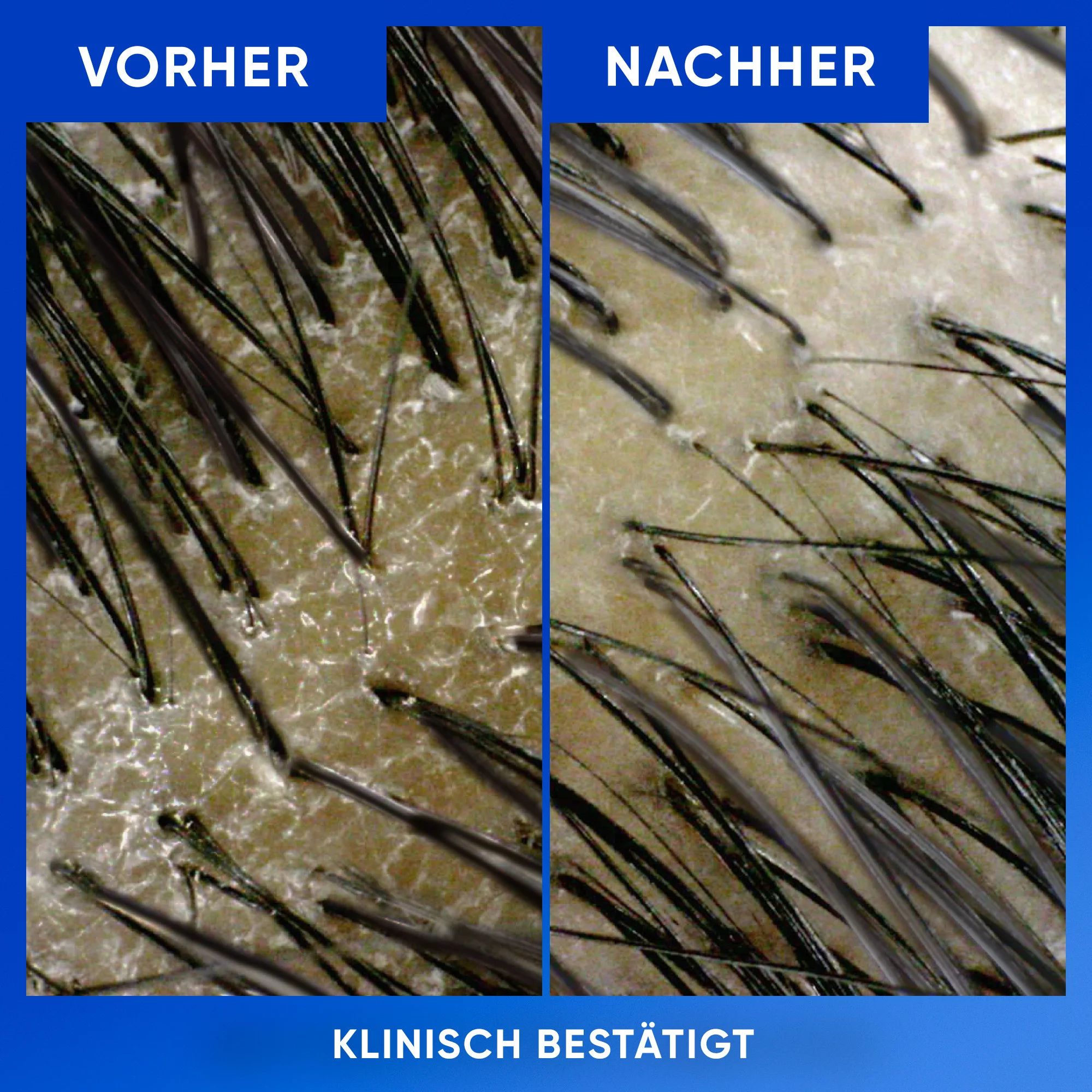 Head & Shoulders Anti-Schuppen Shampoo Reinigung & Glanz
